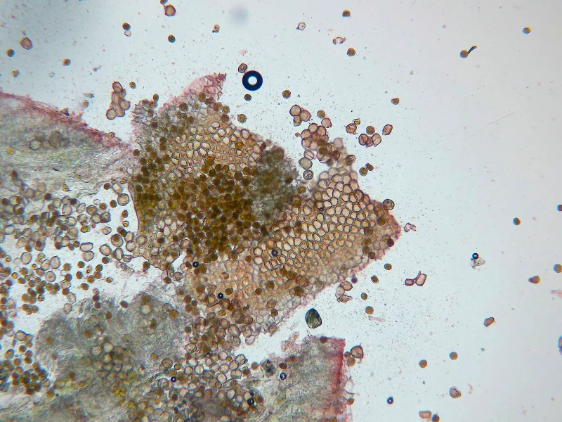 Aecidium ranunculi 13 - Pared ecios x 400